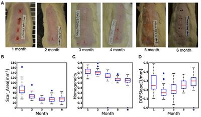 Prediction of Scar Size in Rats Six Months after Burns Based on Early Post-injury Polarization-Sensitive Optical Frequency Domain Imaging